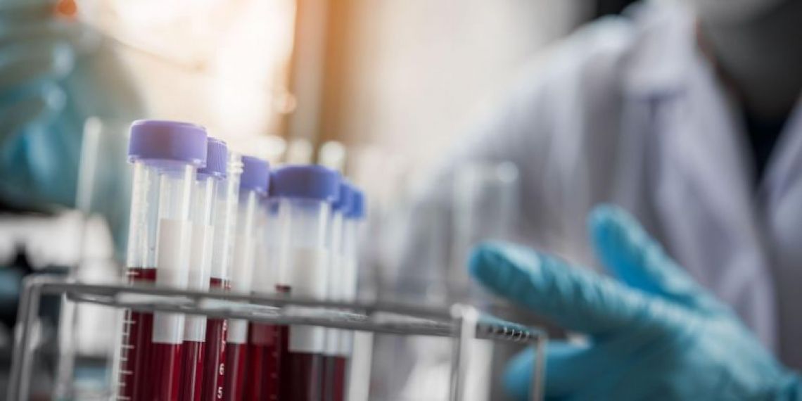 Cancers du col de l’utérus : les test HPV désormais pris en charge à 100 % par l’Assurance maladie