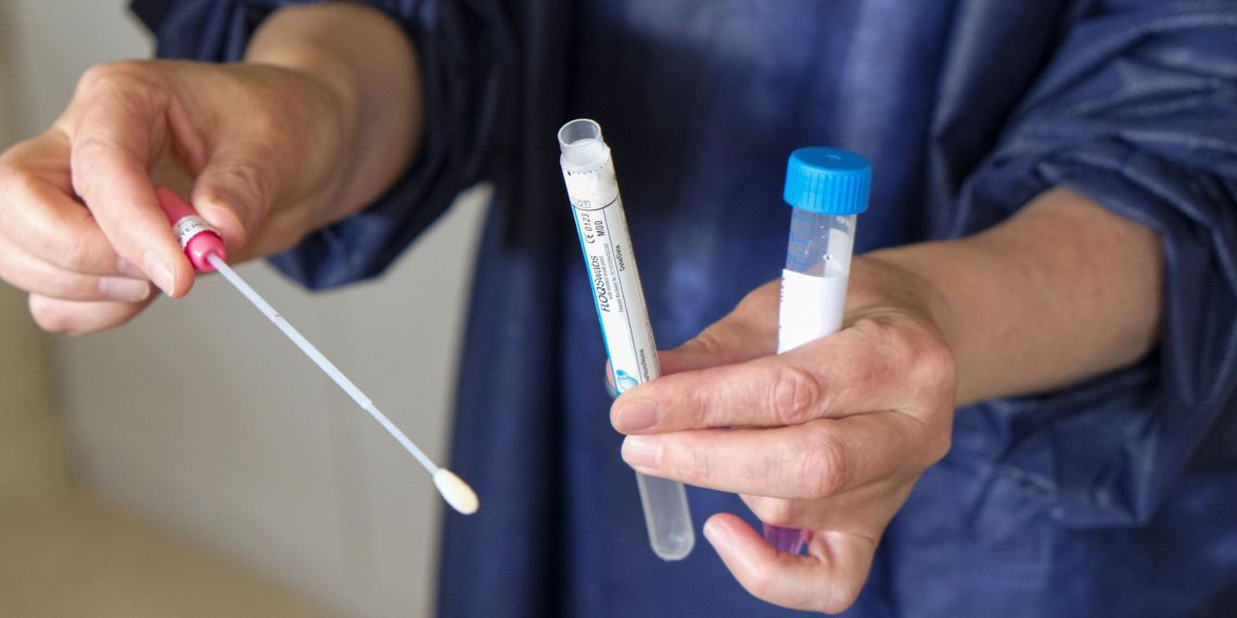 Covid-19 : les tests-antigéniques, remboursés à 100 % par l’Assurance maladie, se généralisent