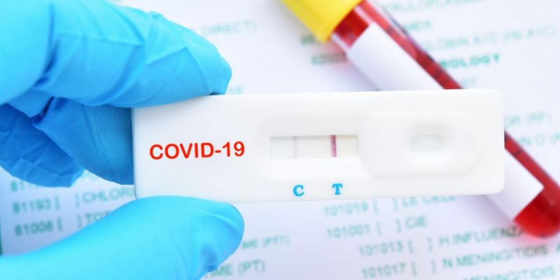 Tests Covid payants dès le 15 octobre : quel sera le coût des tests de dépistage ?