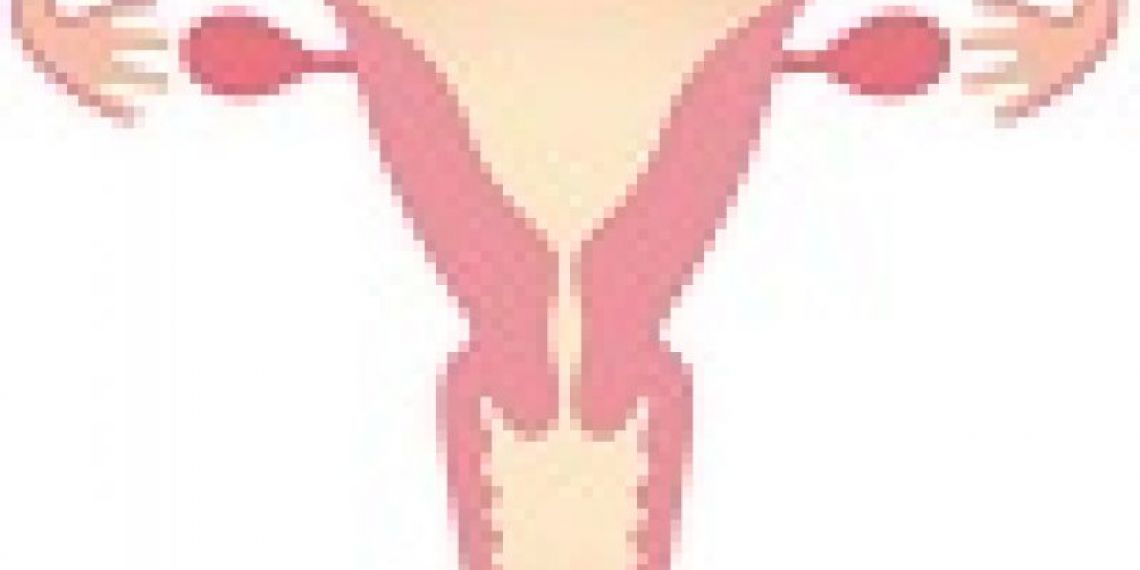 Et si vous pouviez prendre un congé payé en cas de règles douloureuses ?